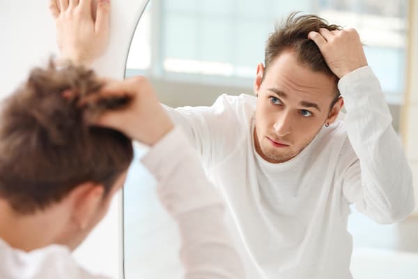 Young-man-with-hair-loss-problem-looking-in-mirror-at-home